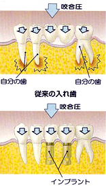 implant_img10